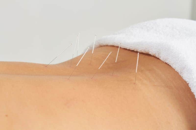 Los puntos de acupuntura para lumbalgia alivian el dolor lumbar