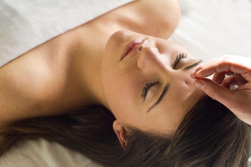 acupuntura para migraña. La fotografía muestra a una mujer sobre una camilla y una mano de un acupuntor introduciendo una aguja en la frente