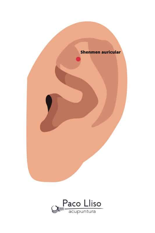 Punto Shenmen auricular. Punto de la auriculopuntura con efecto reconocido para aliviar la ansiedad, estrés y nerviosismo