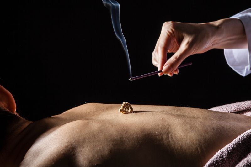 un acupuntor acerca un incienso a un cono de moxa que se encuentra sobre la espalda de un hombre