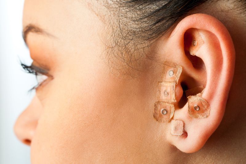 Auriculopuntura para adelgazar es un método viable para reducir el apetito y adelgazar